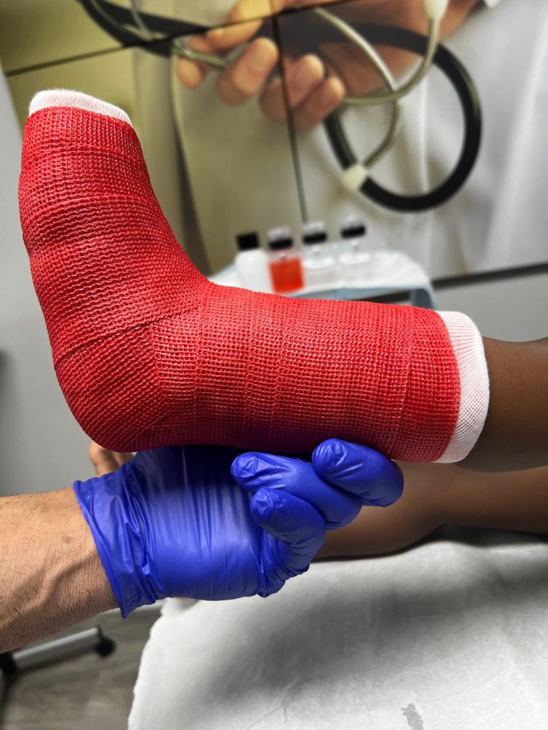 Ankle fractures treated immediately