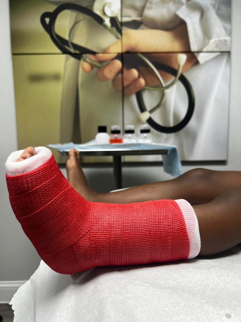 Ankle fractures treated immediately